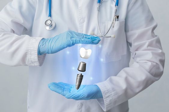 Thách thức thời gian: sứ mệnh của cấy ghép Implant chìa khóa tạo nên nụ cười đẳng cấp.