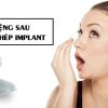 Trồng răng implant có bị hôi miệng không? Tại sao bị hôi miệng khi cấy Implant?