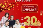 ƯU ĐÃI 30% DỊCH VỤ TRỒNG RĂNG IMPLANT TRONG DỊP TẾT