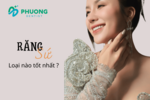 Răng sứ thẩm mỹ loại nào là tốt nhất? Tìm hiều các dòng răng sứ nổi tiếng hiện nay
