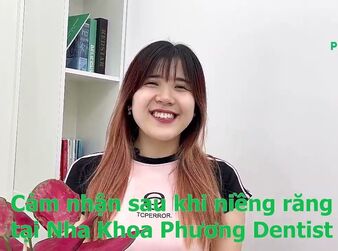 Bạn Hà Phương - Niềng Răng Chỉnh Nha