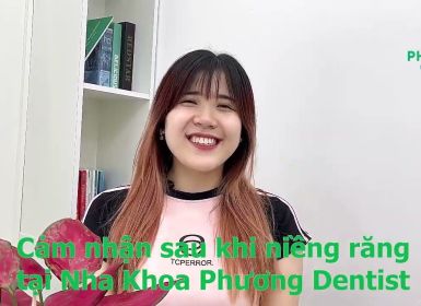 Bạn Hà Phương - Niềng Răng Chỉnh Nha