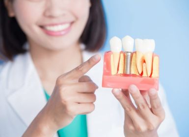 Thời gian chờ làm phục hình trên Implant mất bao lâu?