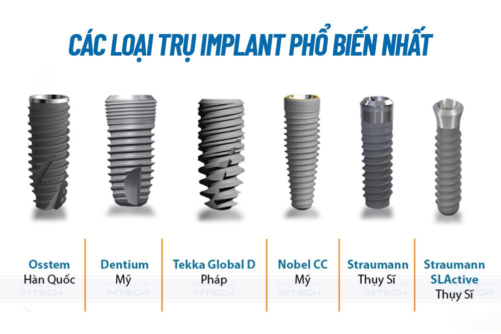 Răng Implant làm từ chất liệu gì?